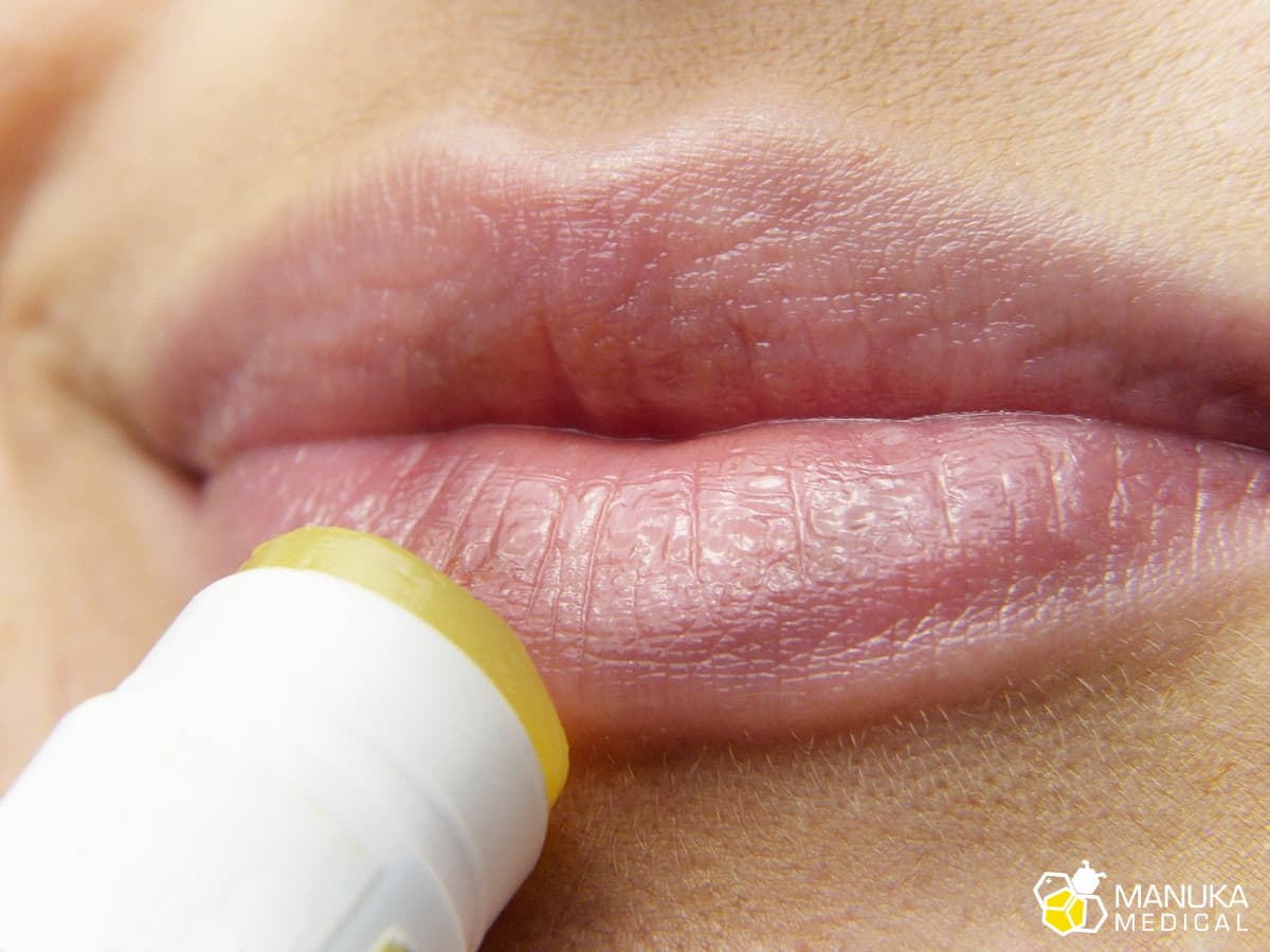 Jak chronić usta przed zimnem, wiatrem a latem przed słońcem?